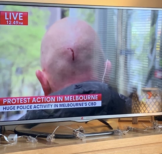 被锁脖、吐<em>口水</em>、泼尿……澳媒记者自称报道墨尔本抗议时受攻击