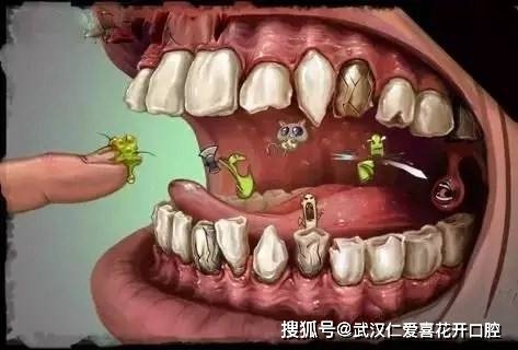 <em>牙齿有</em>这些症状多要小心，都是<em>牙周</em>炎惹的祸，拖久了治疗难花费...