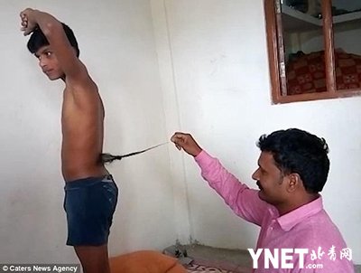13岁印度<em>男孩</em>生来背部长了条“尾巴” 被当地人认为是猴神化身而...