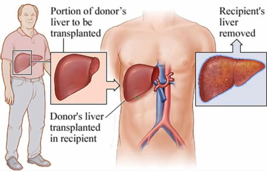 人体器官肝脏可以“再生”吗？它的<em>结构</em>、功能、工作原理<em>是什么</em>...