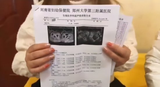 <em>郑州</em>女子怀上八胞胎原因曝光！医生提醒这种药慎用