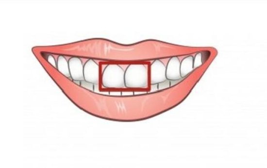 心理测试：你的门牙是哪种？<em>测你人生中</em>到底有没有财运！