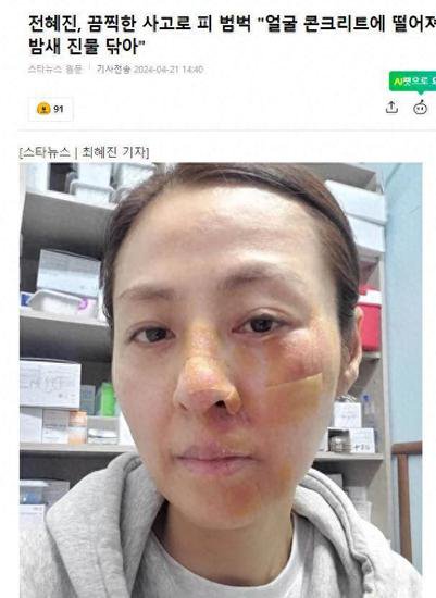 演员全慧珍，被绊倒脸部摔伤，晒出受伤照片，韩网友留言安慰
