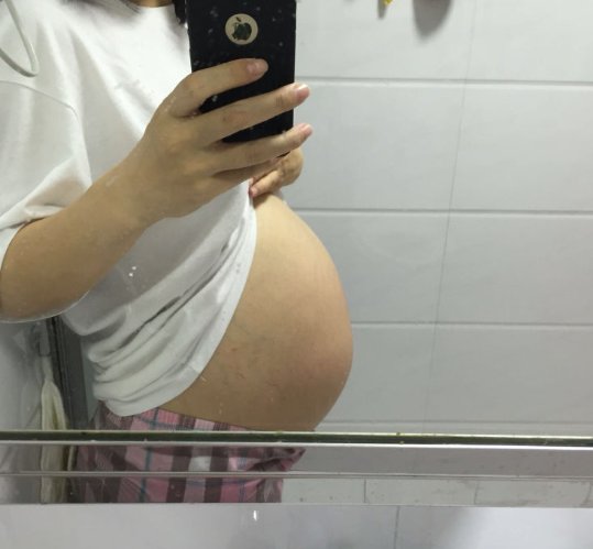 孕27<em>周</em>肚子不显怀，准妈妈粗略的应对，<em>胎儿</em>被迫早产